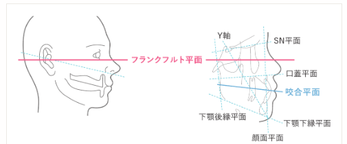 頭部側面から見た咬合平面の図。フランクフルト平面・咬合平面などの基準線を示す