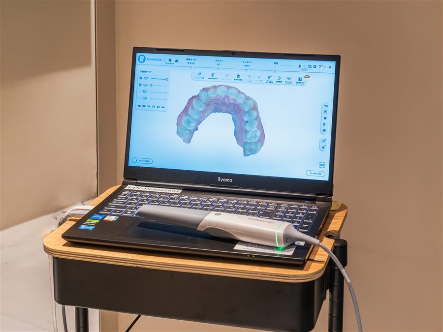 口腔内スキャナーで歯型データを確認する様子