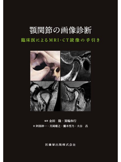 顎関節の画像診断 臨床医によるMRI・CT読像の手引き