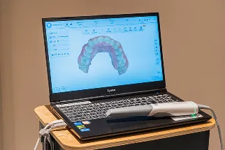 口腔内スキャナーで歯の状態を確認する様子